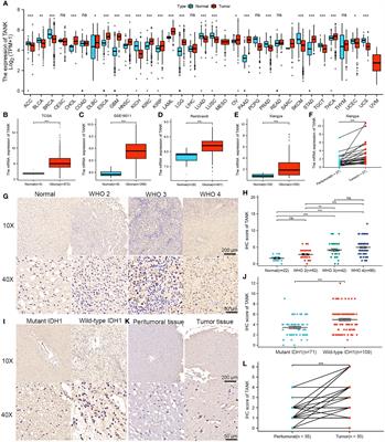 TANK shapes an immunosuppressive microenvironment and predicts prognosis and therapeutic response in glioma